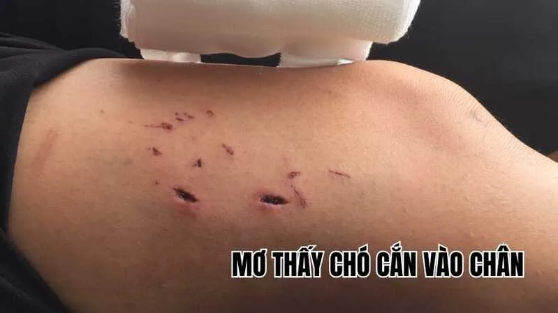 Giấc mơ chó cắn vào chân chảy máu có thể phản ánh tổn thương cảm xúc hoặc một vấn đề đang tác động mạnh đến bạn.