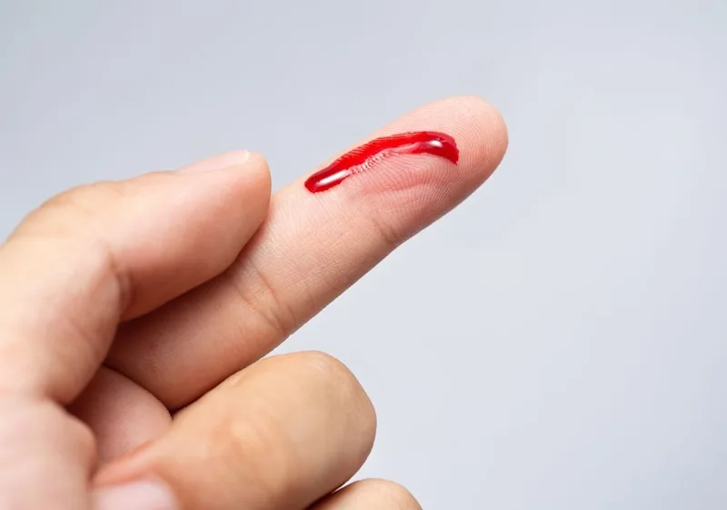 Giải mã điềm báo giấc mơ thấy máu chảy từ các bộ phận trên cơ thể.